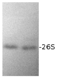DS5a | Drosophila 26S proteasome subunit Rpn10 in the group Antibodies Plant/Algal  / Protein Modifications / Plant Proteasome at Agrisera AB (Antibodies for research) (AS01 012)